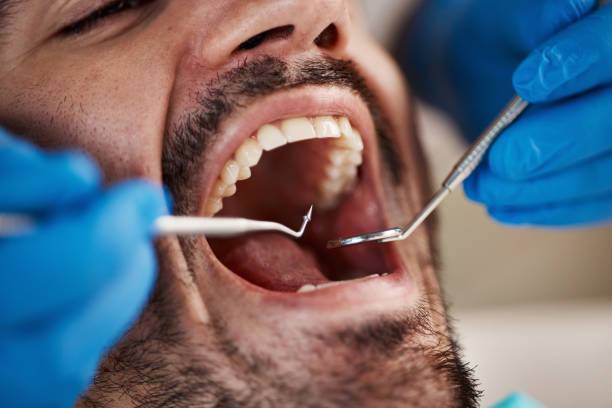 Emergency Dental Services in Cleveland, TX